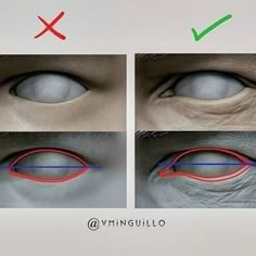 an eye is shown with different colored lines on the iris and in the upper half