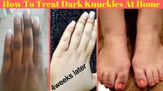 Dark Knuckles, Diy Serum, Natural Nail Art, Skin Care Routine For 20s, Rough Hands, Skin Hand, Coconut Oil For Skin