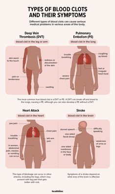 Too Much Estrogen, Health And Fitness Magazine, Healthy Diet Tips, High Blood Sugar, Chest Pain, True Blood, Medical Problems, Blood Vessels