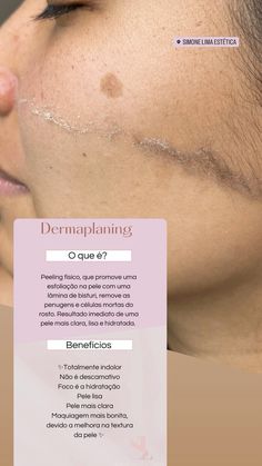 Pele lisa, mais clara, sem penugens e hidratada! Dermaplaning Facial, Dermatological Skin Care, Skin Concern, Flawless Skin, Hair Removal, Clear Skin, Healthy Skin, Skin Types, Sensitive Skin