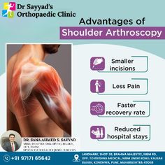 Precision healing for your shoulders! Discover the benefits of Shoulder Arthroscopy at Dr. Sayyad's Orthopaedic Clinic. . 📱 : +919717165642 . 🌎drsanaahmedsayyad.com . 🌎www.facebook.com/drsanaahmedsayyad/ . 🌎 www.instagram.com/drsanaahmedsayyad . . #DrSayyadOrthopaedicClinic #DrSanaahmedSayyad #Orthopaedic #kondhwa #BestOrthopaedicInKondhwa #ShoulderCare #ArthroscopyAdvantages #OrthoExperts Arthroscopic Shoulder Surgery, Rotator Cuff Surgery, Shoulder Dislocation, Therapy Website, Orthopedic Doctor, Rotator Cuff Injury, Life Activities, Orthopedic Surgeon