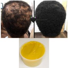 Super Growth Hair Grease, Grow Your Edges,hair Growth, Thick Hair - Etsy UK Hair Growth Grease, Hair Fertilizer, Thicker Stronger Hair, Acne Soap, Accelerate Hair Growth, Bamboo Background