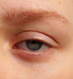 a close up of an eye with brown spots on the outside of its iris area