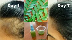 Hair Care Challenge, Hair Fall Remedy Home, Hair Fall Remedy, Hair Grower, Homemade Hair Treatments, Hair Growth Challenge, Get Thicker Hair