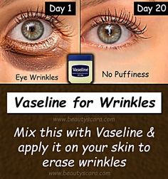 Vaseline Uses and Benefits for Skin, Vaseline On Lips, Vaseline Hacks, Benefits Of Vaseline, Heal Cracked Heels, Pimples On Forehead, Vaseline Uses, Vaseline Petroleum Jelly, Forehead Acne, Skin Wrinkles