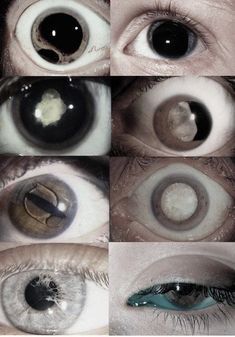 several different pictures of an eye with white and black circles on the iris's eyes