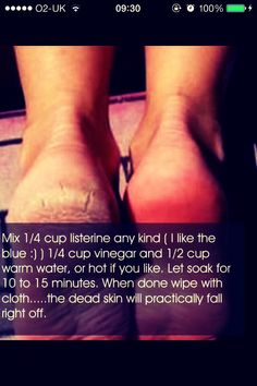 Quick And Easy Way To Soft Feet #Health #Fitness #Trusper #Tip Obličejové Masky, Skin Care Routine For 20s, Beauty Remedies, Pink Eyes, Health And Beauty Tips, Skin Tips, Shampoos, Love Cute, Beauty Treatments