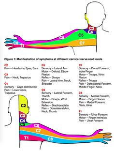 C5 C6 Pinched Nerve, C5 C6 Neck Pain, C5 C6 Neck Pain Exercises, Cervical Radiculitis Exercises, Nerve Exercises, Pinched Nerve, Spine Health, Muscle Anatomy, Human Anatomy And Physiology