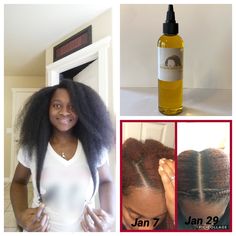 This is for those looking to buy wholesale. It's a minimum purchase of 10 bottles. Fast Natural Hair Growth, Herbal Hair Growth, Black Hair Growth, Hair Growth Women, Natural Hair Growth Oil, Biotin Hair, How To Grow Your Hair Faster, Hair Care Growth, Best Hair Oil