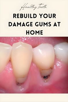 Dental Health Gum Repair, Whitening Teeth, Receding Gums