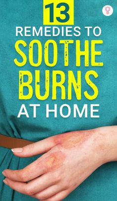 Remedies For Burns Skin, Natural Burn Remedies, How To Heal A Burn Quickly, Burn Care Home Remedies, Diy Burn Relief, Skin Burn Remedy, What To Put On Burns On Skin