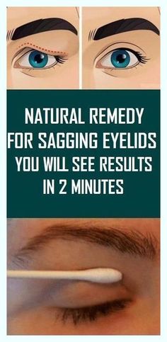 You’ve changed my life. Priceless info! Saggy Eyelids, Droopy Eyelids, Upper Eyelid, Women's Beauty, Lifestyle Habits, Diy Health, Natural Medicine