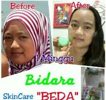 Google+ Inflamed Pimple, Premature Wrinkles, Types Of Fungi, Carboxylic Acid, Collagen Fibers, Acne Cream, Cystic Acne, Shrink Pores, Toner For Face