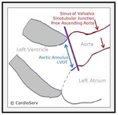 a diagram showing the location of various ventular junctions in an aorta and left atrium