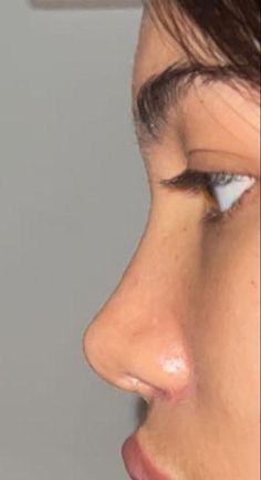 Nose Makeup, Small Nose, Nose Surgery