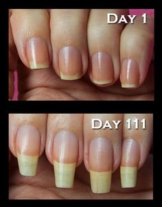 NAIL STRENGTHENER – Method 1 – Soak your nail in 4 tbsp cider vinegar for 2 minutes. Method 2 – Put 1 tsp table salt in a glass of cold water and soak your nails in the solution for 2 minutes Nail Ads, Nail Oil, Nail Strengthener, Nails Polish, Cuticle Oil