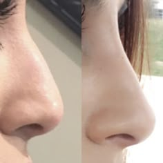 Contour Tricks, Step By Step Contouring, Nose Cleaner, Nose Makeup, Perfect Nose