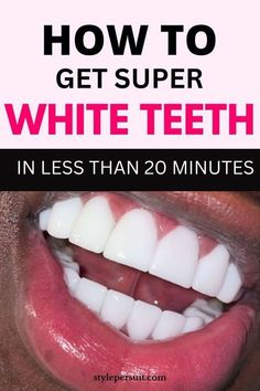 Toothache Relief, Teeth Whitening At Home, Whitening Teeth, Whiter Teeth