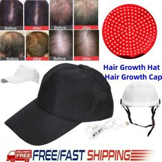 hair strand repair Make Hair Thicker, Brittle Nails, Beauty Gadgets, Laser Therapy, Hair Styler, Amazon Beauty Products