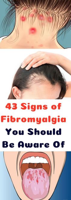 Causes and DiagnosisThe precise cause of fibromyalgia is still not clear, so you can’t prevent it. You can only control it, of course, if you know that you have it in the first place.Since no specific test can help doctors diagnose fibromyalgia, they ask their patients if they feel the below-listed symptoms. Sinus Allergies, Mental Health Articles, Muscle Twitching, Health And Fitness Articles, Pelvic Pain, Cognitive Behavioral Therapy, Behavioral Therapy, Be Aware