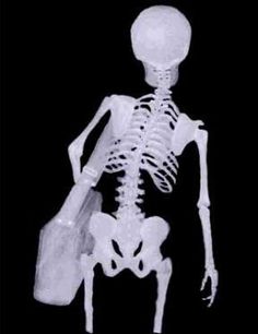 an x - ray image of a skeleton holding a bottle