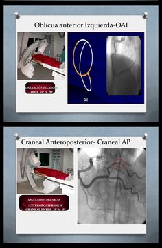 two pictures with different types of medical equipment in them, including an x - ray