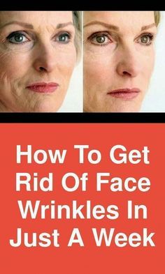 Looking to get rid of wrinkles fast? Check out this blog post on 7 Instant Wrinkle Removers That Work Like Botox! We've got the best instant wrinkle remover products including face serums and creams, and eye creams. Whether you prefer drugstore or high-end options, we've found the best fillers for wrinkles that will have you looking younger in no time. Plus: at-home filler, deep wrinkle filler, wrinkle eraser, wrinkle fillers, line smoothers, best wrinkle filler, wrinkle remedies. Warts On Hands, Warts On Face, Get Rid Of Warts, Natural Cold Remedies, Skin Diseases, Layers Of Skin