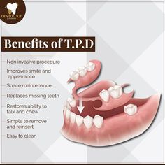 An treatment partial denture, also known as an interim partial denture, is a removable dental appliance used to replace missing teeth.
It is typically made from acrylic or other materials and is designed to be worn by the patient which can be removed and reinserted easily.
They are used for various reasons such as
• Healing and tissue support,
• Aesthetic considerations,
• Functional purposes. Removable Partial Denture, Support Aesthetic, Teeth Study, Dental Appliance, Dental Advertising, Dental Education, Laboratory Design