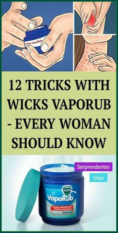 EVERY WOMAN SHOULD KNOW THESE 12 TRICKS WITH VICKS VAPORUB Water Retention Remedies, Nail Care Diy, Natural Hair Growth Remedies, Nail Fungus Remedy, Cough Suppressant, Healthy Life Hacks