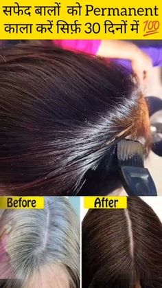 How To Prevent White Hair, Remedy For White Hair, Black White Hair, Instagram White