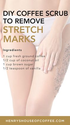 Prevention is the best method to avoid embarrassing stretch marks. Read on to learn about coffee scrub for #stretchmarks from #HenrysHouseofCoffee blog. | Skin Care Tips | Coffee Tips #DIYRemedy #coffeetips #coffeescrub Diy Coffee Scrub, Apothecary Shop, Coffee Facial, Stretch Mark Removal, Home Remedies For Hair, Sugar Scrubs