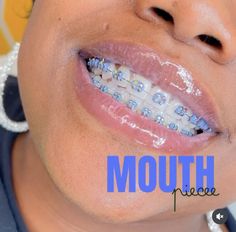 Lime Green Braces, Mint Green Braces, Sky Blue Braces, Braces Colors Ideas Dark Skin, Royal Blue Braces, Light Blue Braces, Brace Colors, Braces Aesthetic