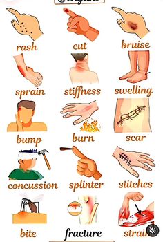 a poster showing different types of hands and fingers with words above them that describe the parts of