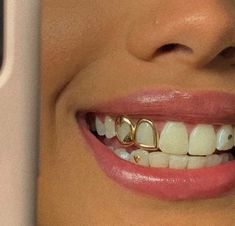 a close up of a person with braces on their teeth and a cell phone in front of them