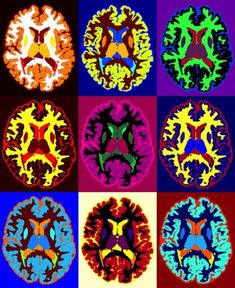 six different colored brain images in squares