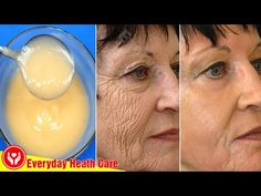 I'm Going Crazy About This Mixture || It Makes Me Look Younger Only With 3 Ingredients - YouTube Wrinkles Remedies Face, Wrinkle Remedies, Wrinkle Free Skin, Erase Wrinkles, Natural Face Skin Care, Skin Care Wrinkles, Younger Skin