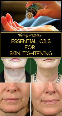 Get Rid Of Saggy Skin, Skin Tightening Essential Oil, Diy Skin Tightening, For Skin Tightening, Top Essential Oils, Essential Oils For Skin, Oil Uses, Sagging Skin