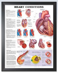 an image of heart conditions chart with pictures and instructions on the front page, framed in black wood frame