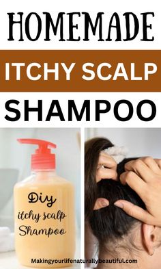 Does your scalp also itches ? Then learn here how to make shampoo for itchy scalp at home. Home remedies for itchy scalp, diy soap recipes. Homemade shampoo recipe. Itchy scalp, dry scalp. Diy Shampoo Recipe Homemade, How To Treat Itchy Scalp, Scalp Cleanser Diy, Itchy Scalp Remedy Diy, Remedies For Itchy Scalp, Deb Hair, Make Shampoo, Itchy Scalp Remedy, Dry Scalp Remedy