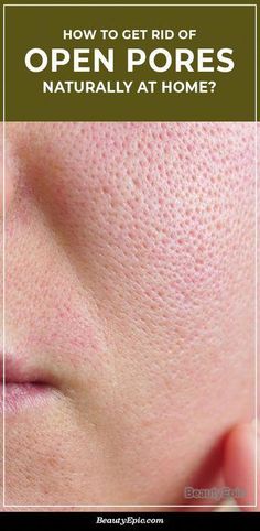 Minimize Pores Naturally, Big Pores, Face Pores, Beauty Hacks Skincare, Smaller Pores, Natural Face Skin Care, Make Up Videos, How To Get Rid Of Pimples