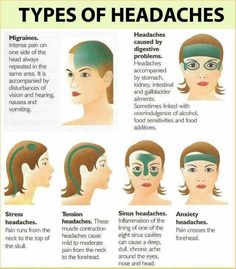 Good to know Different Types Of Headaches, Bolesti Chrbta, Headache Types, Reiki Meditation, Migraine Relief, Headache Relief, Migraine Headaches, Medical Knowledge