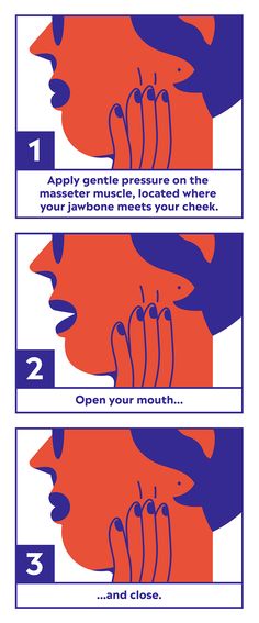 Masseter Massage diagram - Instantly get rid of headaches Relieve Tension Headache, Headache Remedy, Getting Rid Of Headaches, Natural Headache, How To Relieve Headaches, Self Massage