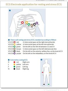 Easy Ekg Interpretation Cheat Sheets, Ekg Basics Nursing, Emt Notes, Ecg Placement, 12 Lead Ekg Interpretation Made Easy