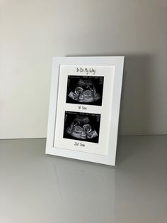 an x - ray image of two baby feet in black and white