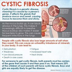 Cystic fibrosis Medical Diseases, Medications Nursing, Nurse Tips, Scientific Method Worksheet, Medical Study, Nclex Review, Nursing Life, Healthy Lungs