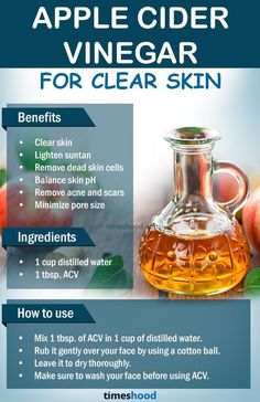 Get Clear Skin Naturally, For Clear And Glowing Skin, Apple Cider Vinegar Remedies, Clear And Glowing Skin, Clear Skin Naturally, Benefits Of Apple Cider Vinegar, Benefits Of Apple Cider, Benefits Of Apple