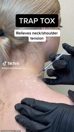 Plastic surgeon weighs in on beauty trend 'traptox' - which sees women getting Botox in SHOULDERS | Daily Mail Online Shoulder Tension