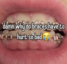 What Can I Eat With Braces, What To Eat With Braces, What Can I Eat, Eat Pizza, Very Funny Pictures, What To Eat, Just Girly Things