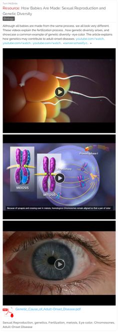 three different views of an eye with the iris opened