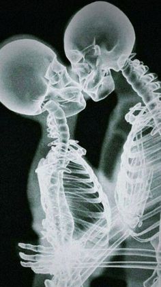 an x - ray image of two people holding each other's hands and looking at something in the distance